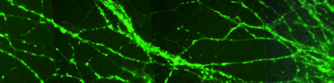 Microscopic green and black image showing connection between neurones
