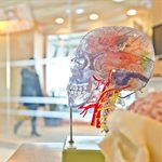 Brain training cuts epileptic seizures