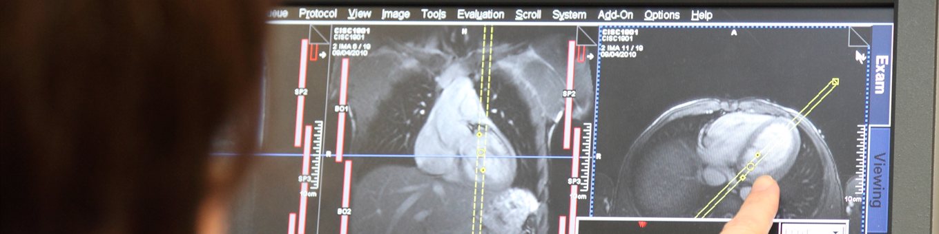 A computer displays medical scans of a heart