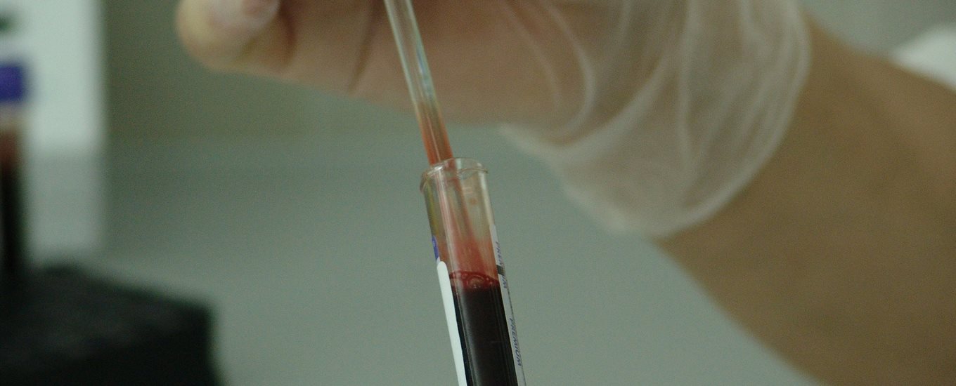Taking a sample of blood from a test tube