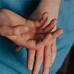 A close up of someone's hands folded on their lap