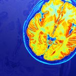 Bugs, drugs and brain scans: Exploring the molecular mind