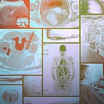 Image is everything: Promoting radiology in medical education