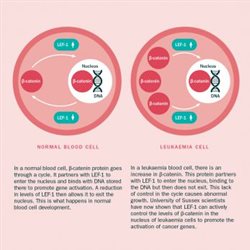 Diagram showing a 'normal' red blood cell vs a Leukaemia infected cell