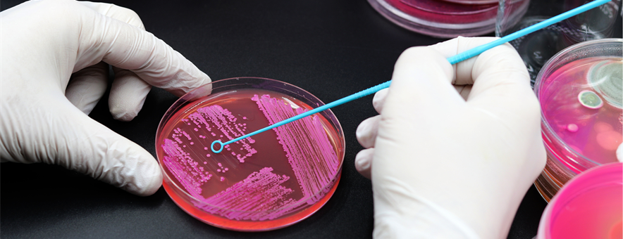 Gloves holding a petri dish and using a stick to insert into it