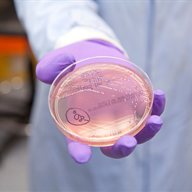 Hand holding petri dish in lab