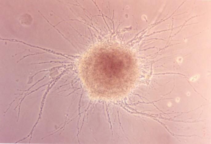 Microscopic image of a Neurone