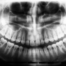 Dental x-ray close up image