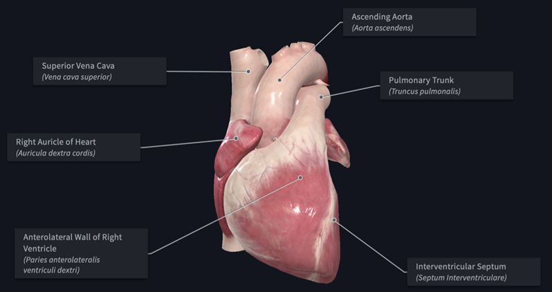 Example of complete anatomy
