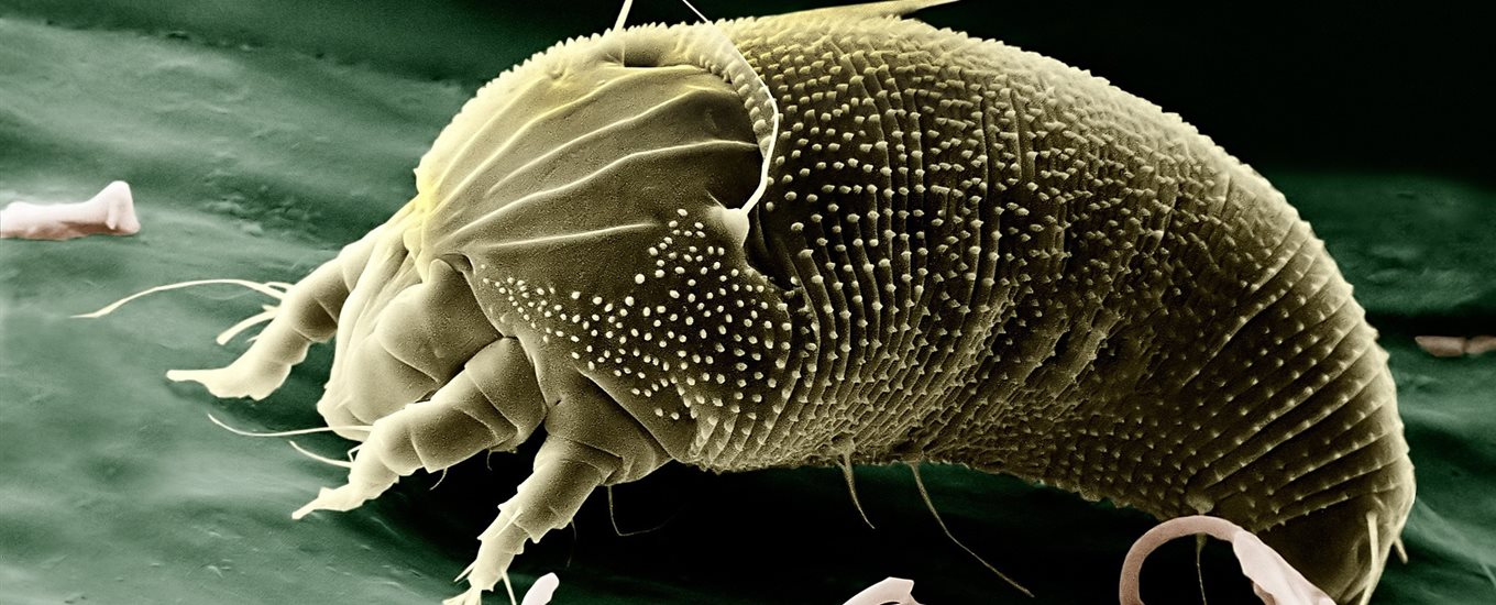 scabies mite