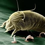 A medicine that could control outbreaks of scabies in the UK remains unlicensed