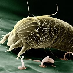 scabies mite microscopic image