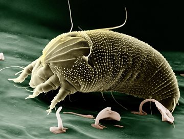 scabies mite