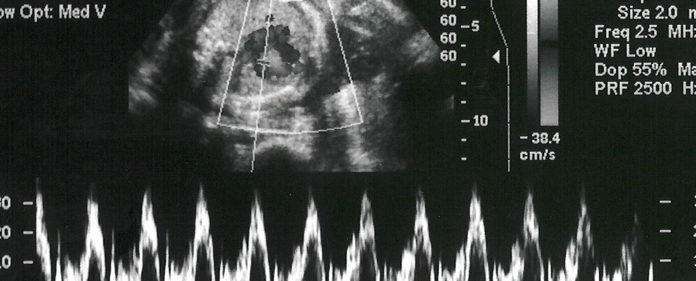 An ultrasound scan