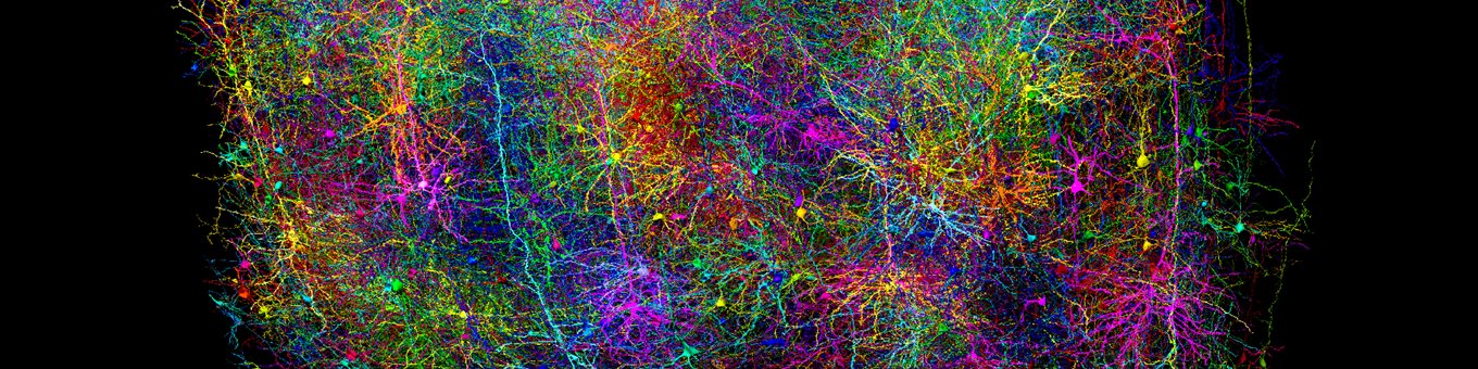 A scan of a brain in multiple colours