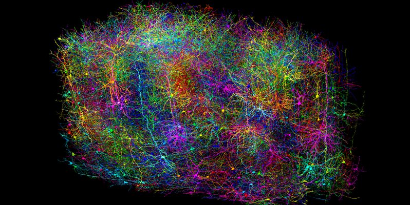 A scan of a brain in multiple colours