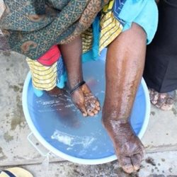 Washing feet with Podo symptoms in a blue bowl
