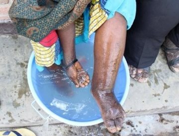 A Black person washing their feet in a blue bowl with their hands