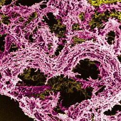 Microscope image showing the TB virus