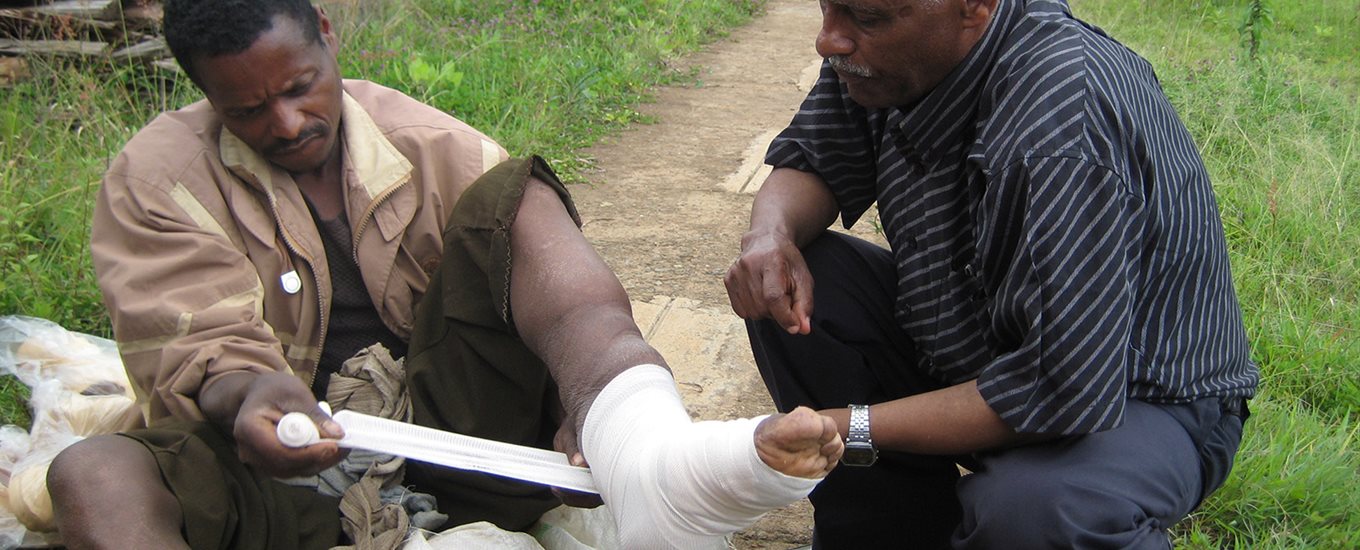 Man with Podo symptoms bandaging his own foot