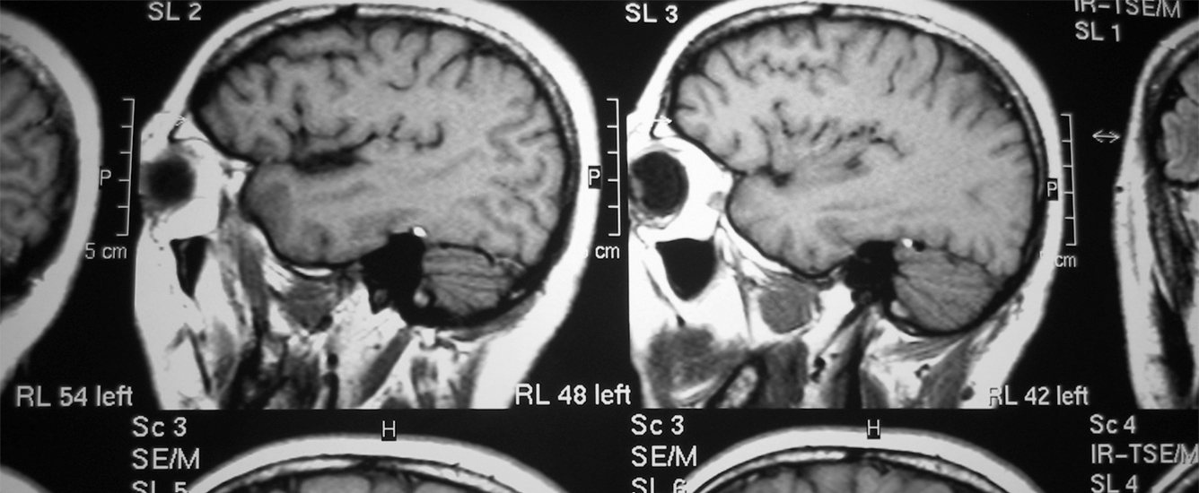 Brain scans