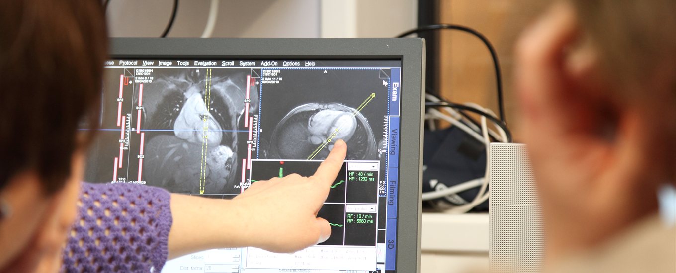 Someone pointing at a computer screen displaying medical scans of the body