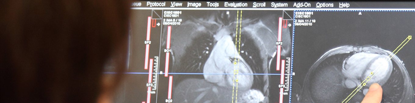 A finger pointing at a scanA finger pointing at a scan