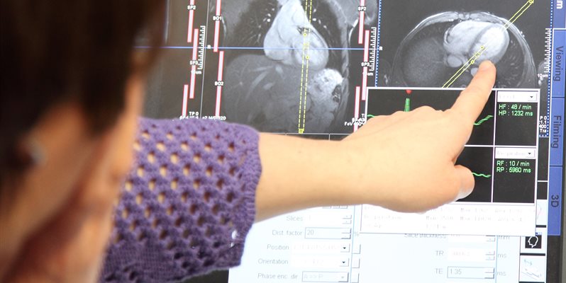 finger pointing scan